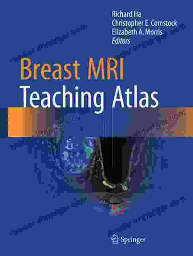 Breast MRI Teaching Atlas Cover Breast MRI Teaching Atlas Kristie Leong M D