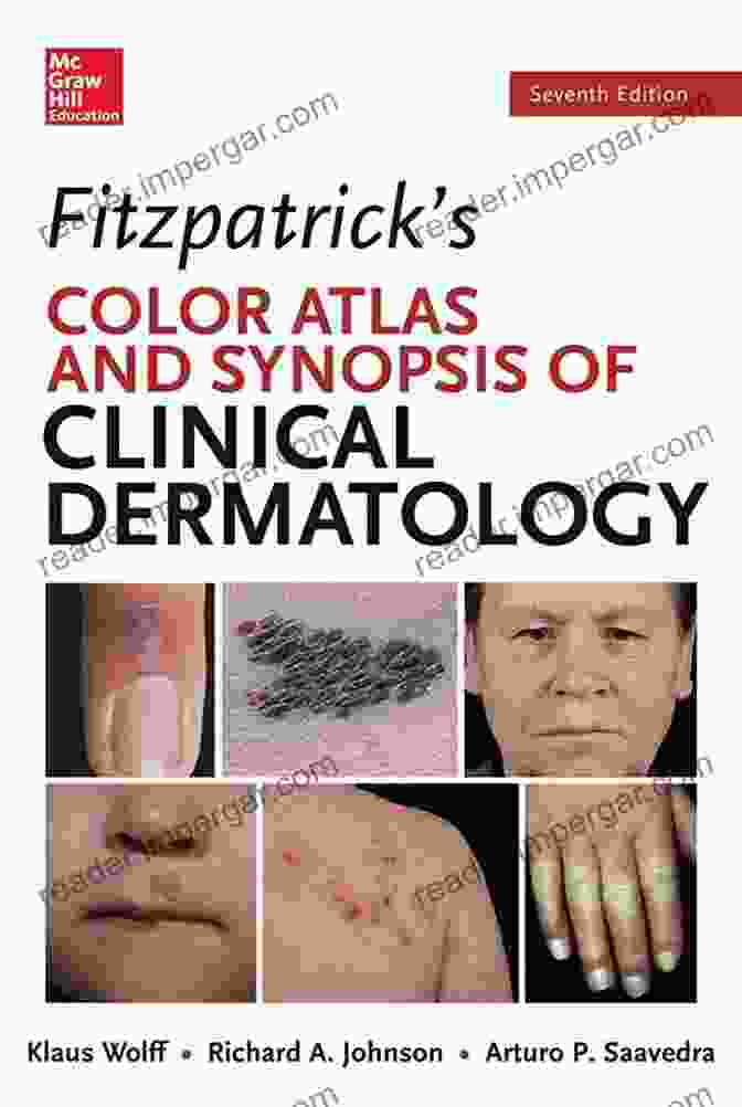 Fitzpatrick's Color Atlas And Synopsis Of Clinical Dermatology, Seventh Edition Fitzpatrick S Color Atlas And Synopsis Of Clinical Dermatology Seventh Edition (Color Atlas Synopsis Of Clinical Dermatology (Fitzpatrick))