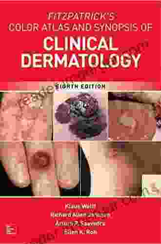 Fitzpatrick S Color Atlas And Synopsis Of Clinical Dermatology Seventh Edition (Color Atlas Synopsis Of Clinical Dermatology (Fitzpatrick))