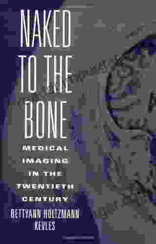 Naked To The Bone: Medical Imaging In The Twentieth Century (Sloan Technology Series)